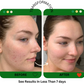 PREMIUM 100% VEGAN GLOW UP Toner Serum + HYPER HYDRATOR Face Moisturizer With SPF 30