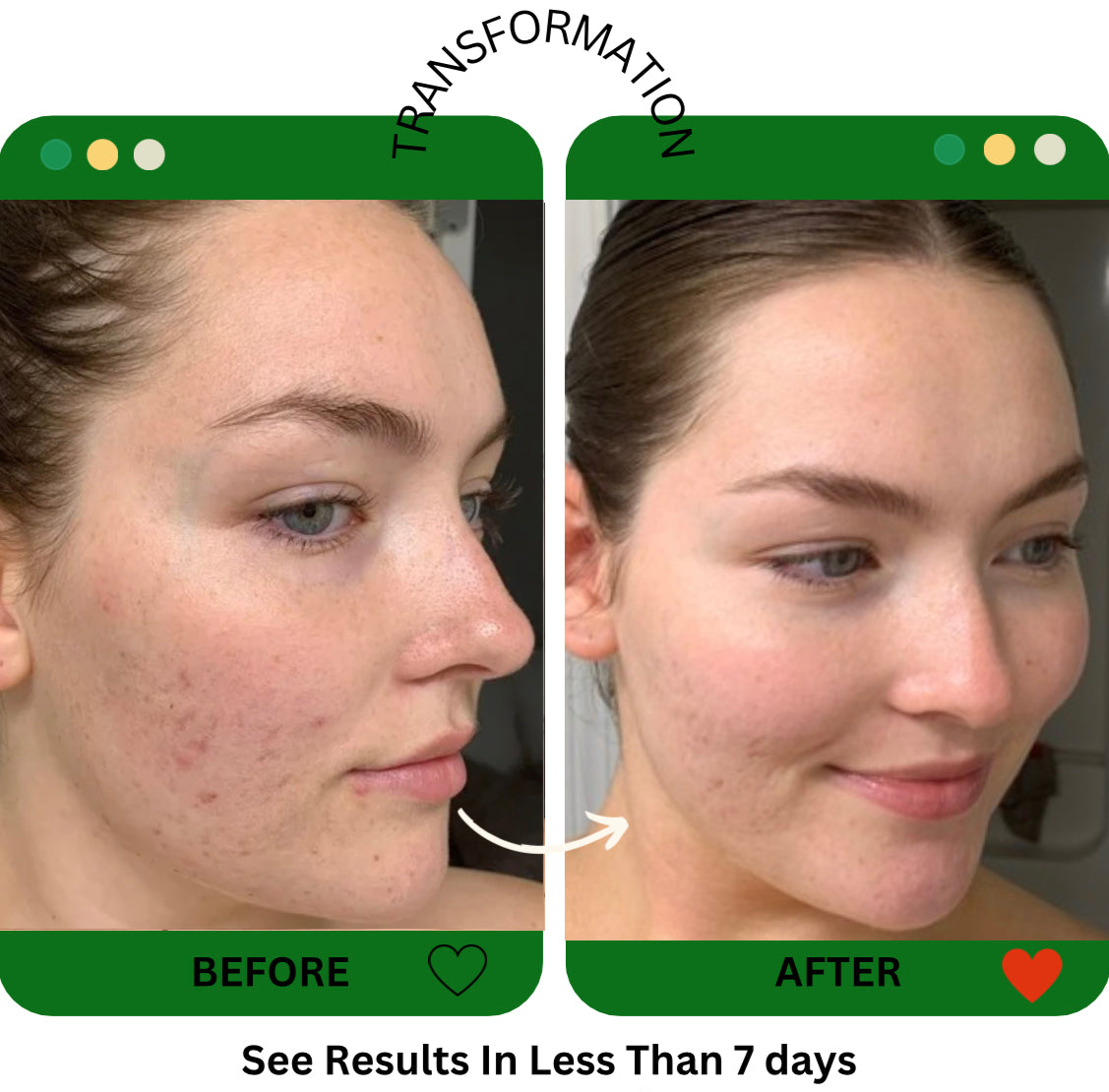 PREMIUM 100% VEGAN GLOW UP Toner Serum + HYPER HYDRATOR Face Moisturizer With SPF 30