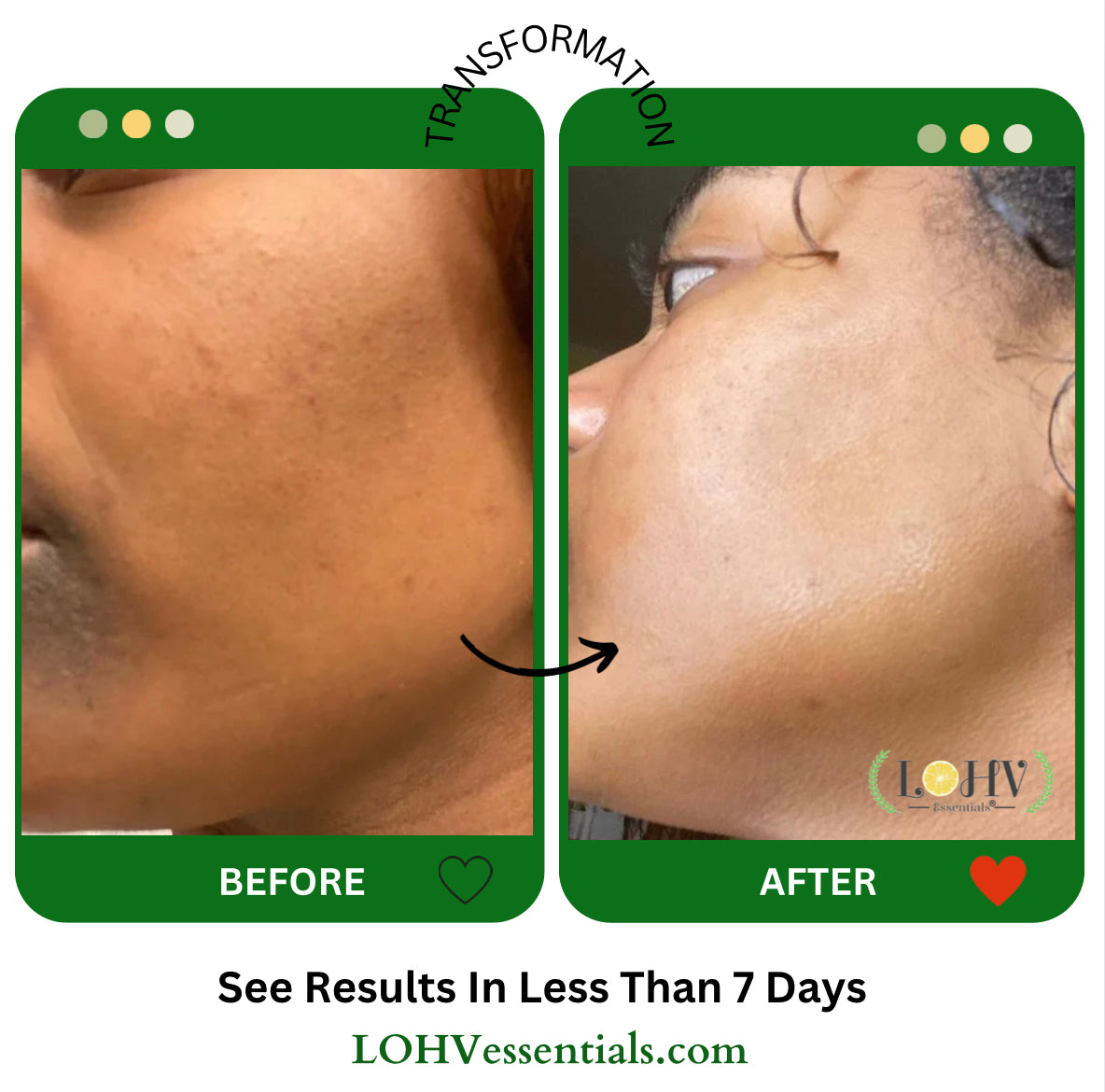 PREMIUM 100% VEGAN HYPER HYDRATOR Face Moisturizer With SPF 30 + Hyaluronic Acid + Lactic acid + Vitamin C + Kombucha