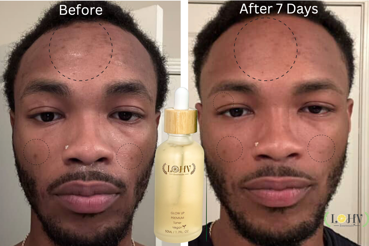 PREMIUM 100% VEGAN GLOW UP Toner Serum + HYPER HYDRATOR Face Moisturizer With SPF 30