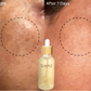 PREMIUM 100% VEGAN GLOW UP Toner Serum + HYPER HYDRATOR Face Moisturizer With SPF 30
