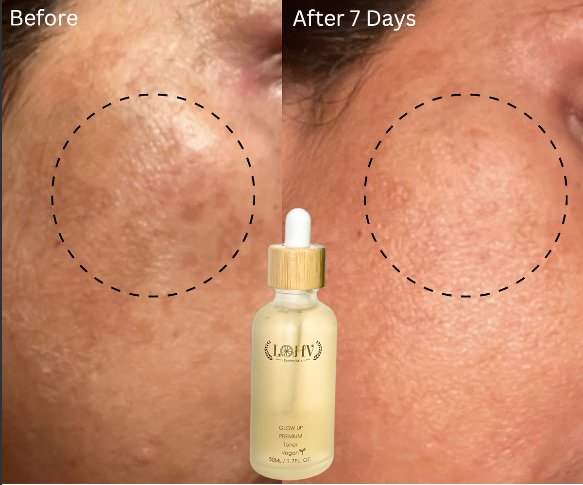 PREMIUM 100% VEGAN GLOW UP Toner Serum + HYPER HYDRATOR Face Moisturizer With SPF 30